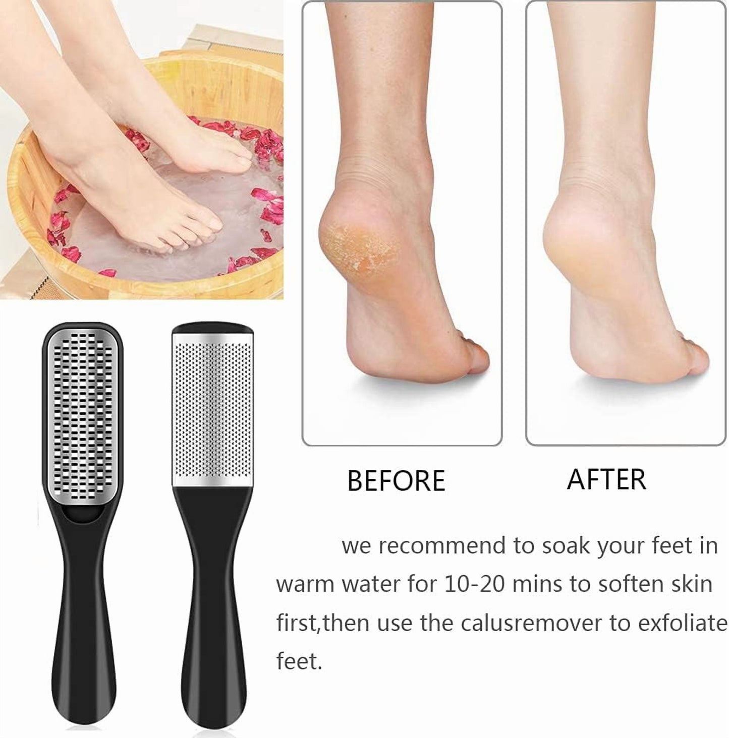 Livhil 36 in 1 Professional Pedicure Kit, Stainless Steel Pedicure Tools for Feet, Foot Care Kit for Women and Men